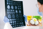 Eggs and Alzheimer’s breakfast, Eggs and Alzheimer’s, eggs may help prevent alzheimer s study, Tops