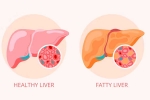 Grade 2 Fatty Liver latest breaking, Grade 2 Fatty Liver breaking, how to reverse grade 2 fatty liver, Liver health Grade 2 Fatty Liver latest breaking, Grade 2 Fatty Liver breaking, how to reverse grade 2 fatty liver, Liver health