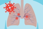 Kawasaki disease, immune system, how does covid 19 affect different parts of the body, Spanish flu