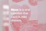 mpox mortality rate, mpox symptoms, mpox emergency again, Mpox