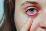 Conjunctivitis videos, Conjunctivitis treatment, special measures to prevent conjunctivitis, Body organs