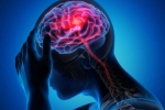 Canada Brain Disease symptoms, Canada Brain Disease cases, canada is hit by a mysterious brain disease, Urologist